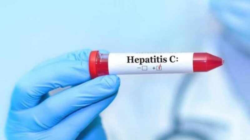 hepatitis c